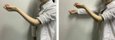 创伤导致肘关节僵硬怎样才能康复,肘关节僵硬康复训练正确方法