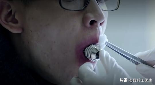 为什么会把异物塞进尿道,为什么会有人往尿道里塞异物