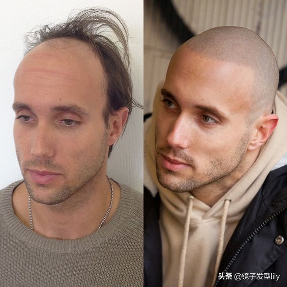 男士发型怎么剪才能让头发变蓬,头顶稀疏不烫头发型男