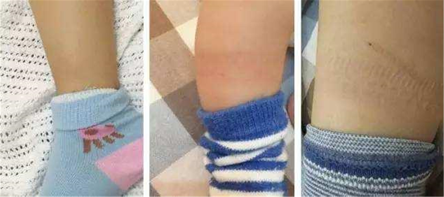 孩子死活不爱穿袜子怎么办,孩子不乐意穿袜子