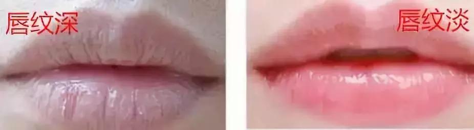 唇纹深显老吗,唇纹深好不好