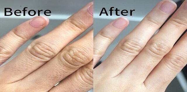 怎么让粗糙手变滋润小妙招,手部干燥怎么护理快速嫩白