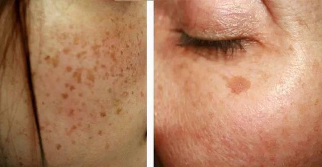 拒绝斑点不做斑点女孩,拒绝纹身女生