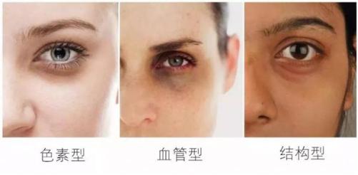 涂眼霜不能消除黑眼圈那要怎么办,正确涂眼霜淡化黑眼圈的方法