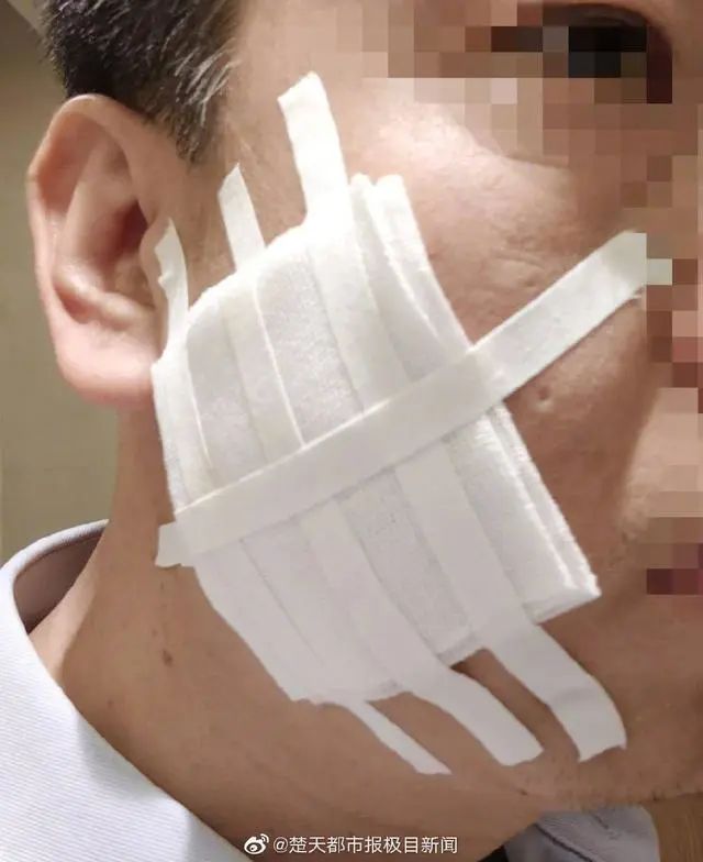 高管用烟头烫员工脸,员工之间职场霸凌行为该如何界定