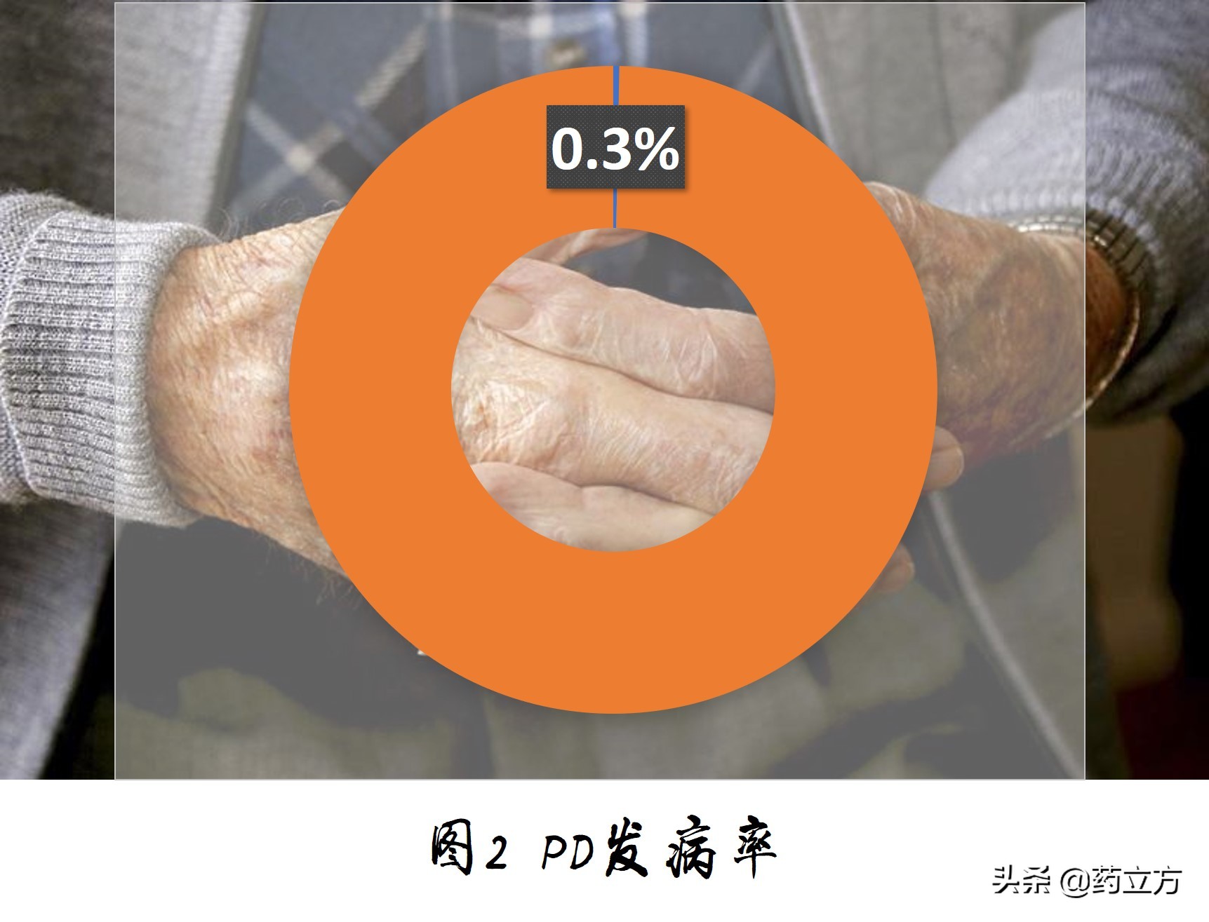 手抖震颤帕金森小妙招,出现手抖一定是患上了帕金森吗