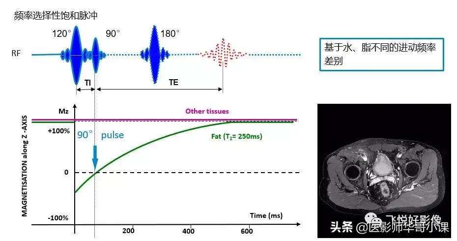 飞利浦磁共振独有技术,飞利浦磁共振减影技术