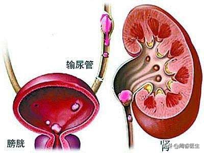 警惕平滑肌收缩引起的疾病（痉挛、头痛、痛经等）