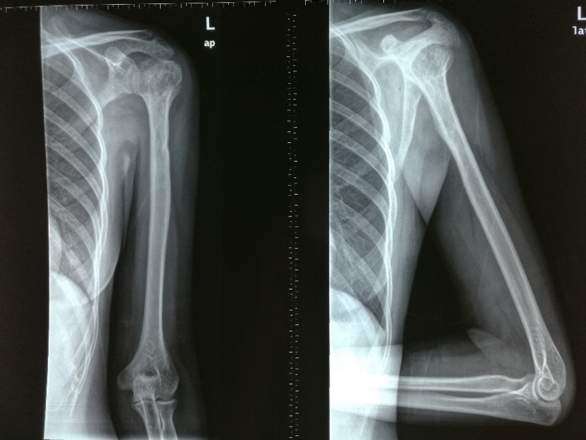 风湿科常见病,罕见的风湿免疫系统疾病