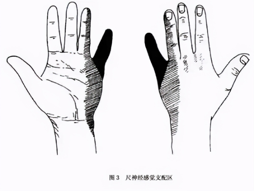 小指麻木，千万别忽略了它