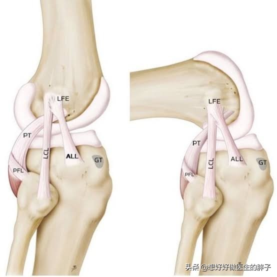 什么是肌腱损伤,怎么判断是韧带损伤还是肌腱炎