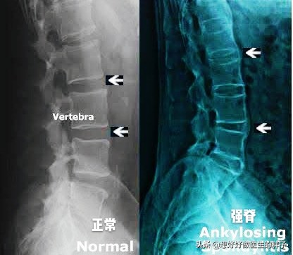 背部内侧疼痛怎么解决男性,年轻男性右侧背部疼痛
