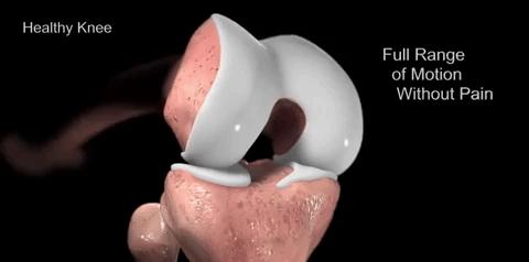 医院治髌骨软化症怎么样,专家教你快速治疗膝关节