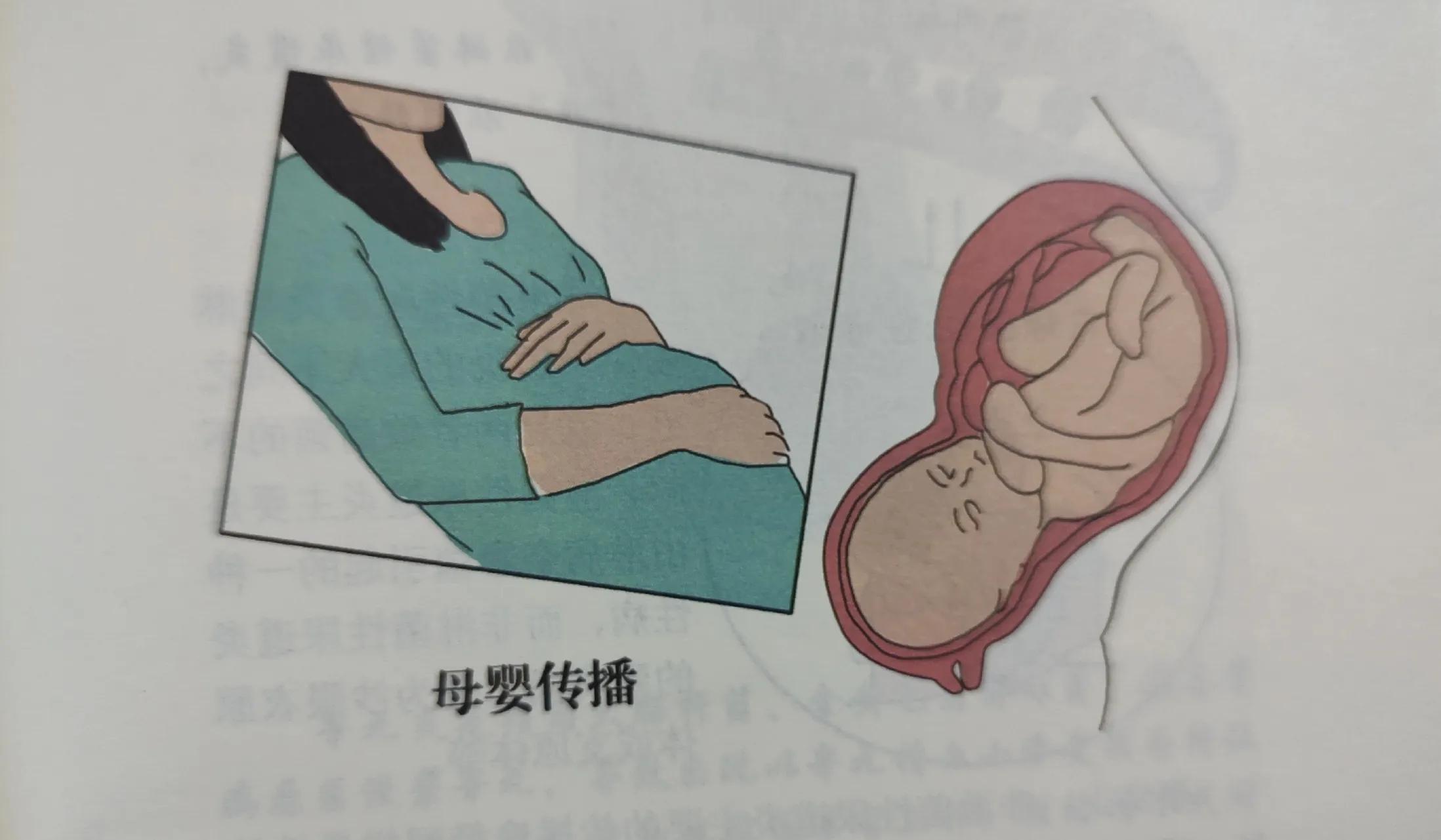 尿道感染发炎症状,淋病和尿路感染是一种病吗