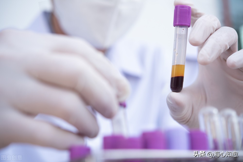 化疗肝损伤多久能保肝恢复,化疗引起的肝损伤吃什么药