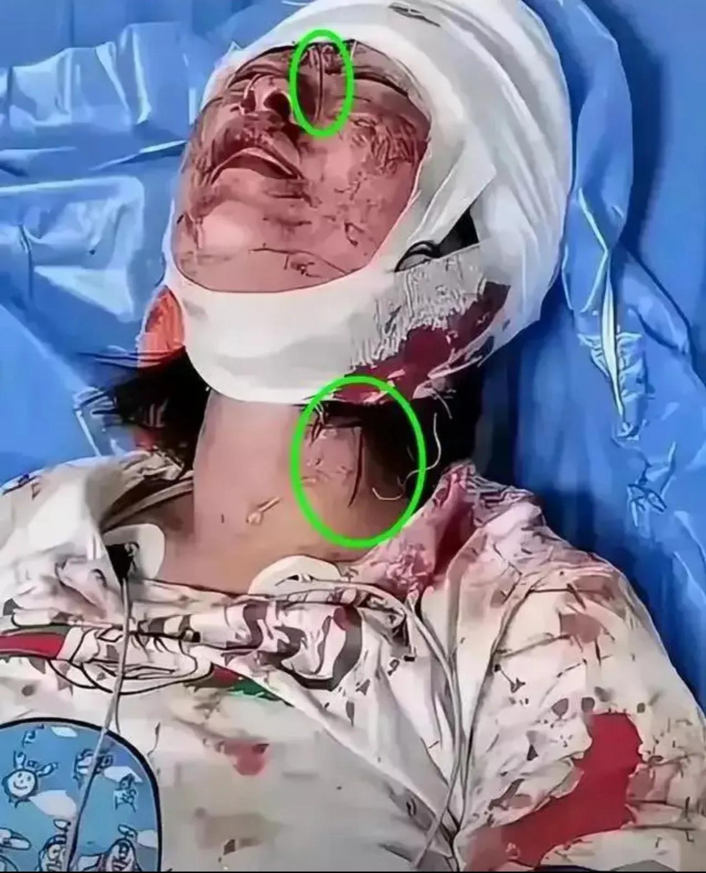 唐山打人事件9人分别判了几年,唐山打人案事件最终被判了多少年