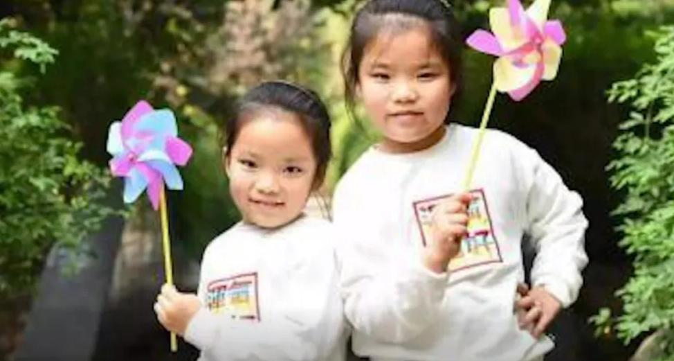 连体婴姐妹18年成功分离,连体婴姐妹成功分离后续