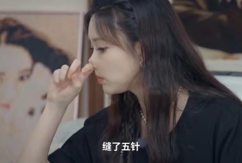 女明星的脸被人用刀刮,女子脸被刀刮毁容