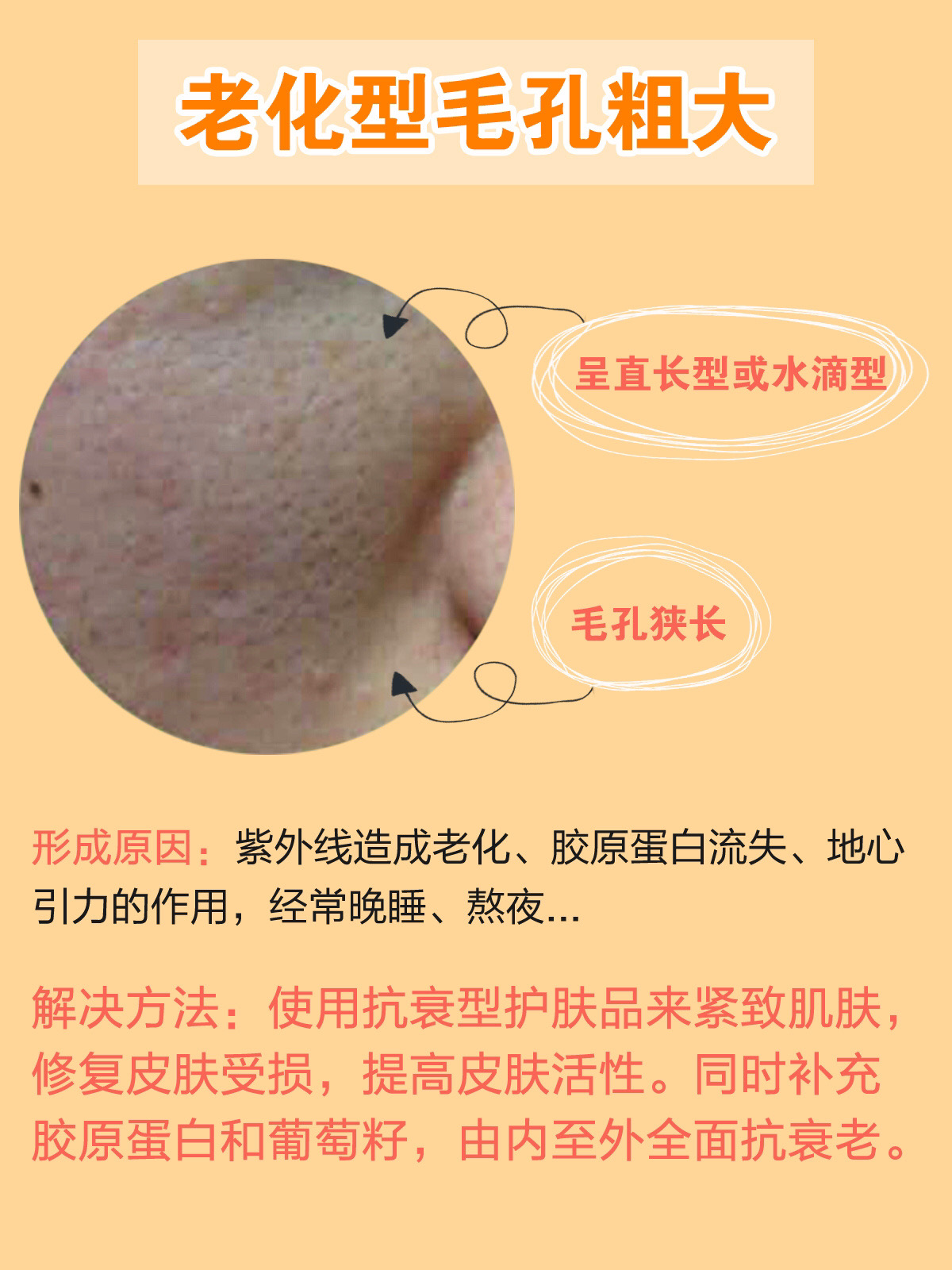 毛孔粗大也有办法改善皮肤科普,毛孔粗大最全攻略解决办法