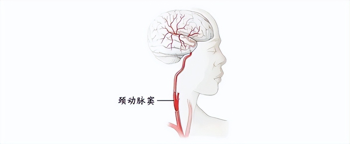 200元内超高性价比颈椎按摩器测评,品牌颈椎按摩器测评