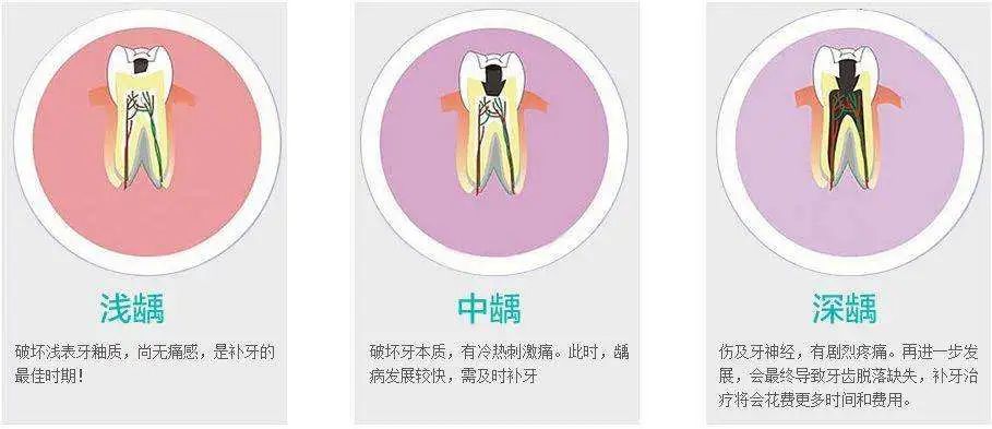 牙疼得要命会自愈吗,牙疼硬抗多久能把牙神经扛过去