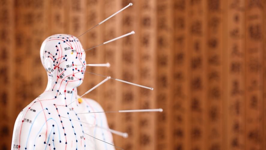 针灸治疗湿疹视频,针灸治疗慢性湿疹