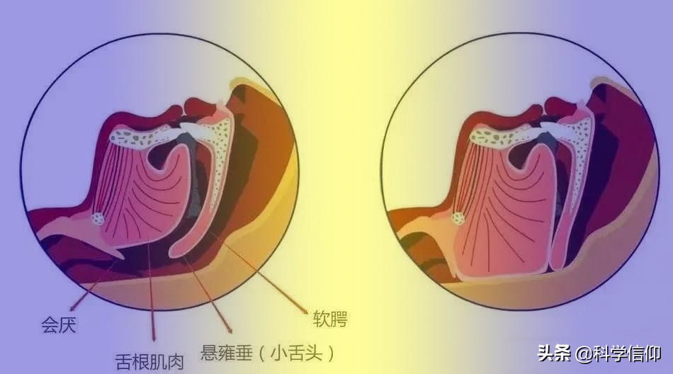 打鼾引起呼吸不畅喉咙干燥,打鼾为什么窒息都不醒过来