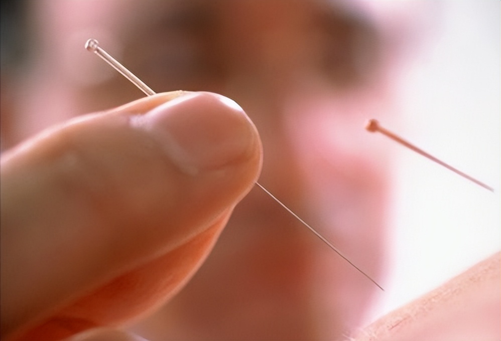 中医针灸治疗腰痛病的学术思想,古法针灸临床治验