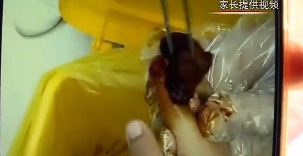 ​深圳三岁女童因“事太多”，导致园长老师齐痛哭，园长：求你转学