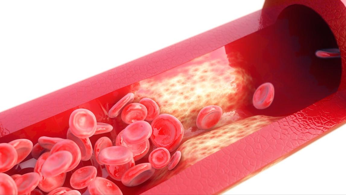 高血压引起脑出血最佳抢救时间,家里老人有点脑出血一般怎么治