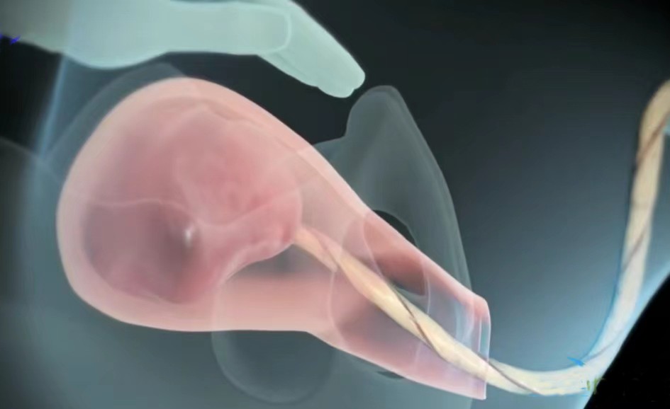 顺产3d动画流程讲解,顺产生孩子母爱伟大