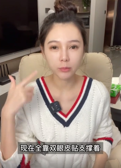 女网红整容变化,整容失败女网红对比