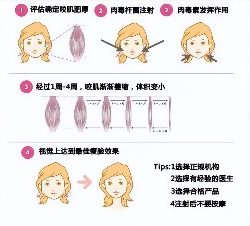 笑的时候脸颊有两坨肉怎么改善,笑起来脸上鼓出两坨肉僵硬