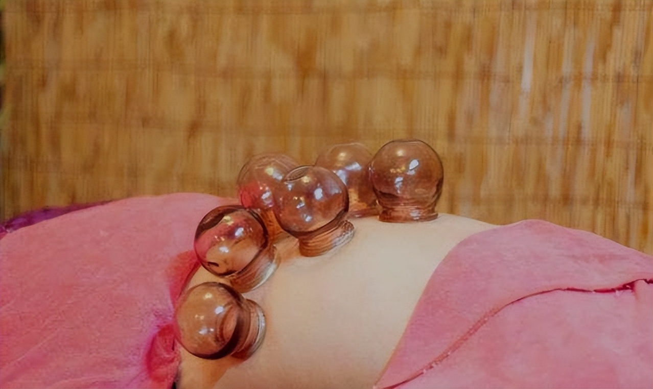 拔火罐吸出来的是湿气还是毒素,拔火罐时吸出的淤血是毒素吗