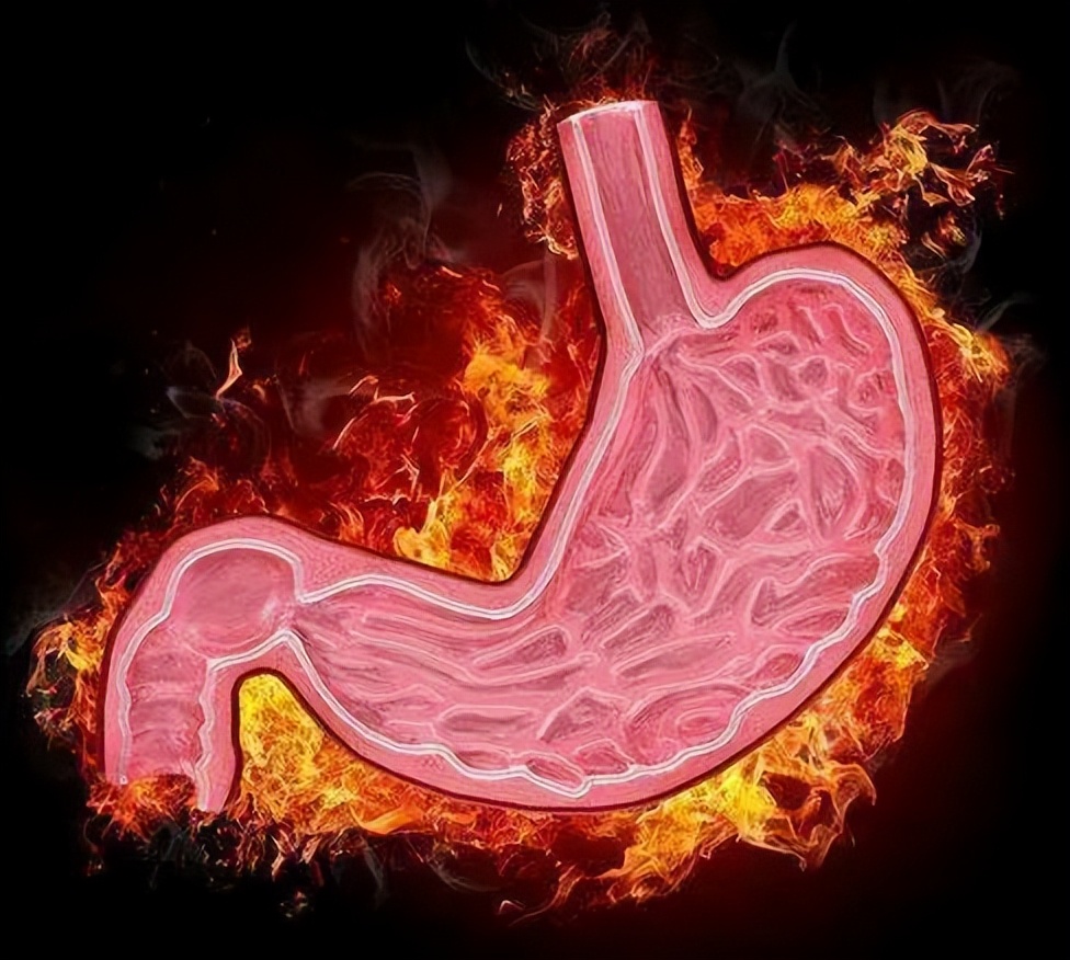 人为啥喜欢吃高钠食物,如何避免摄入高盐