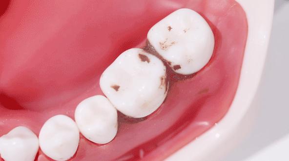 电动冲牙器便携式深层清洁牙齿,牙刷电动软毛护牙