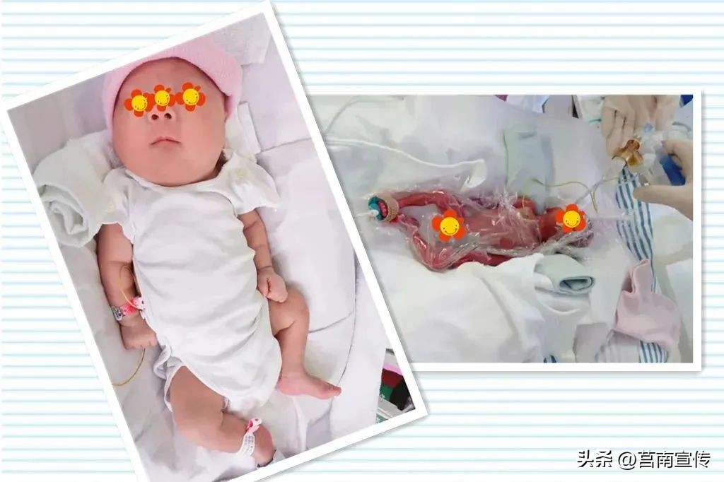 早产儿体重2斤能存活吗,不到两斤的早产儿能存活吗