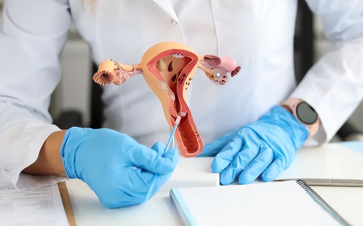 为什么月经结束后,会出现“褐色分泌物”?早了解早清楚