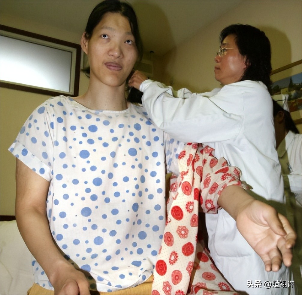 安徽女巨人姚德芬身高,女巨人姚德芬一生简历