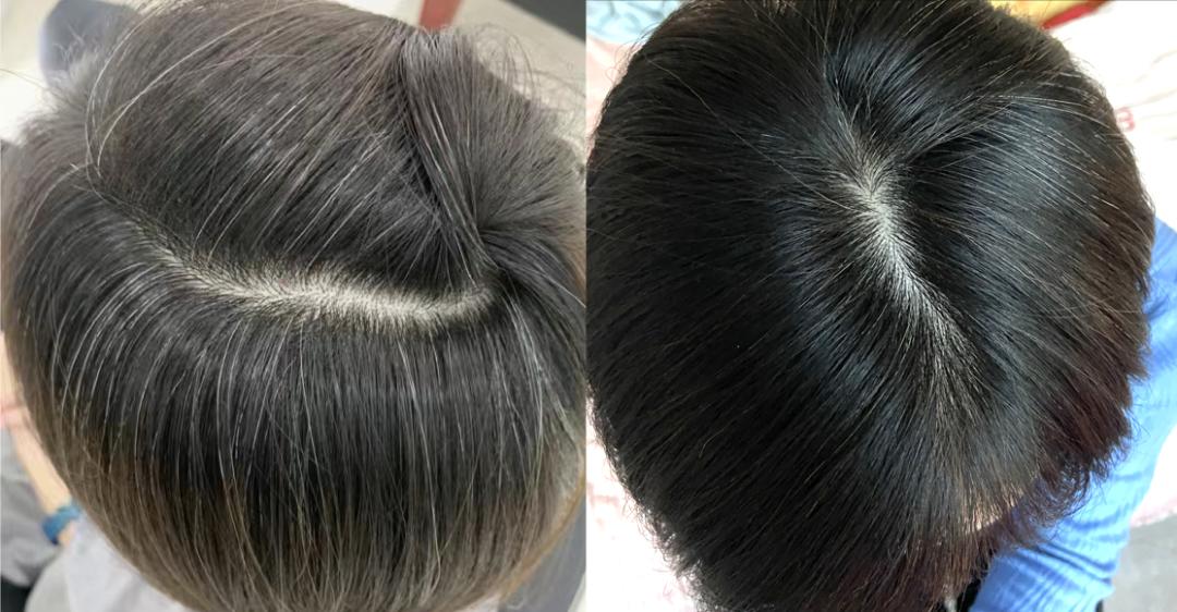 淘米水让白发变黑发吗,淘米水洗发水真的能让白发变黑吗