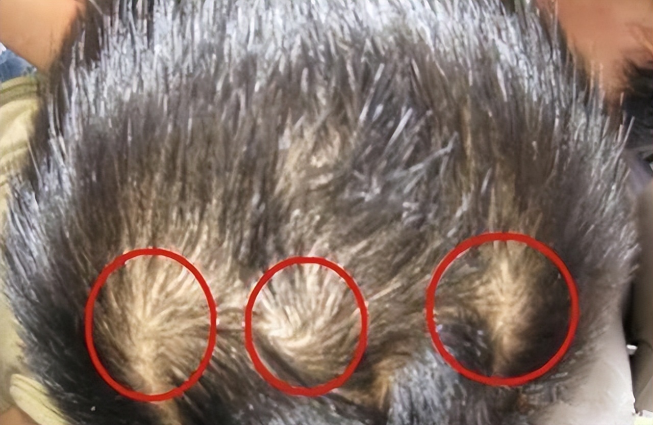 孩子头上的旋代表什么,小孩头顶的旋很重有什么寓意