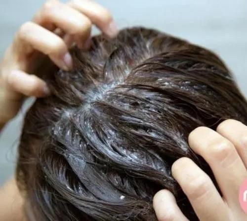 头皮上长红疙瘩脓包是什么原因,头皮经常起小脓包疙瘩很疼