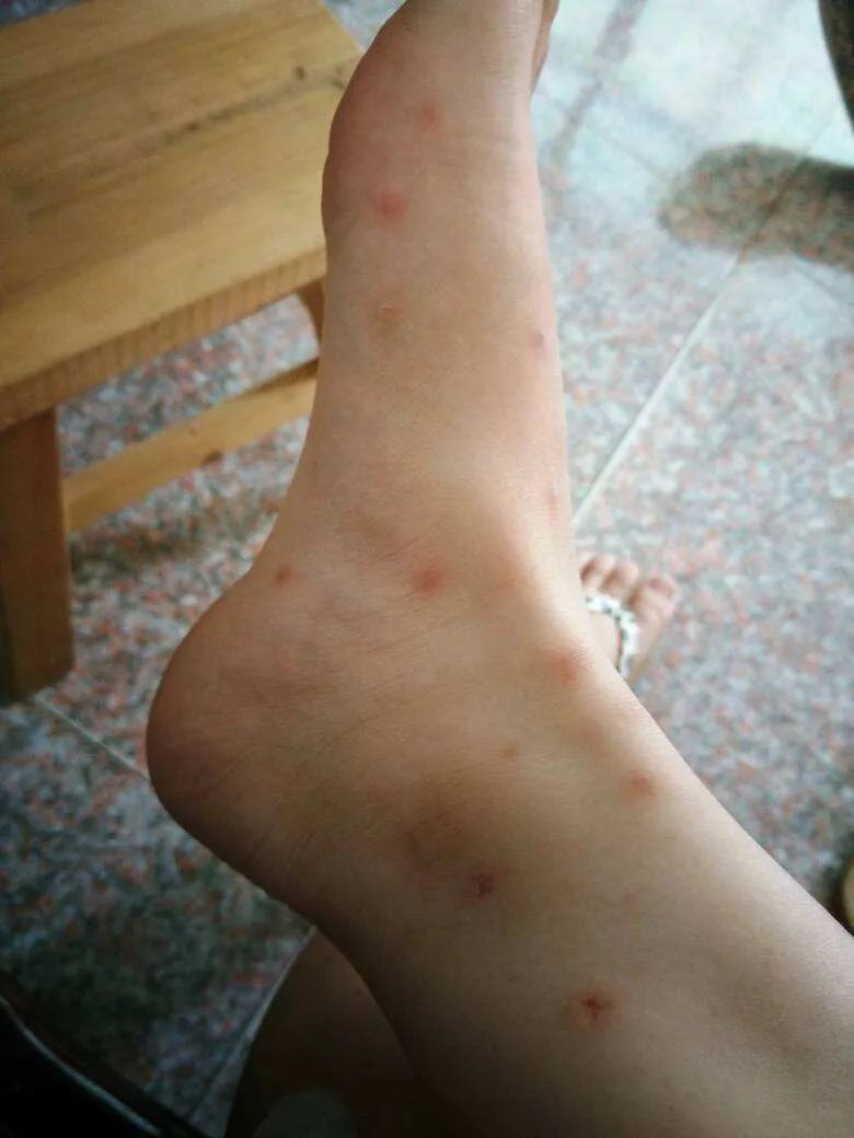 怎么断定猫咪身上有没有跳蚤,怎样判断猫咪身上有跳蚤