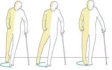 脑梗有哪些征兆和症状,无任何征兆脑梗