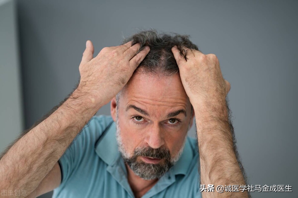 脱发白发谢顶怎么调理,脱发谢顶补充什么营养