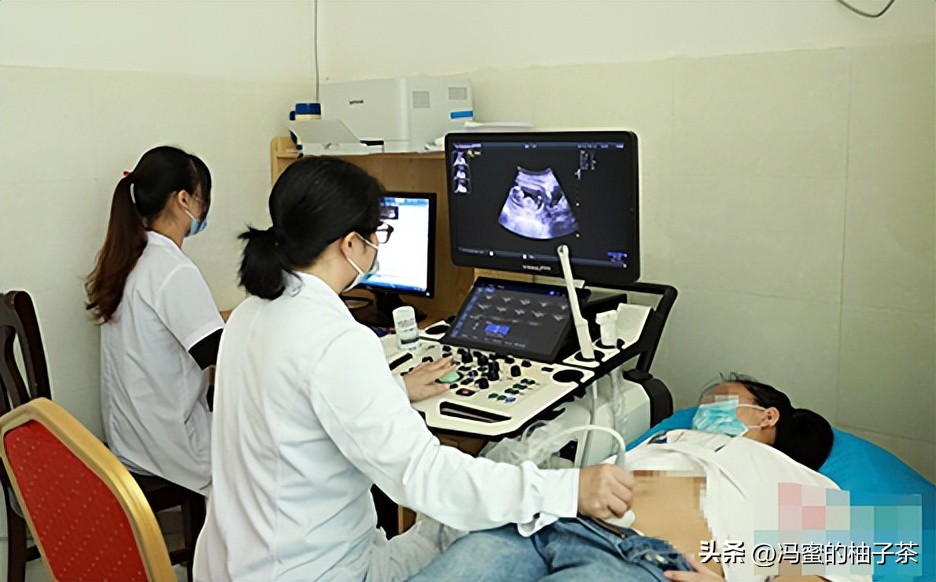 2009年湖南女子生下重2斤小猴子,湖南女子生了个小猴子上综艺节目