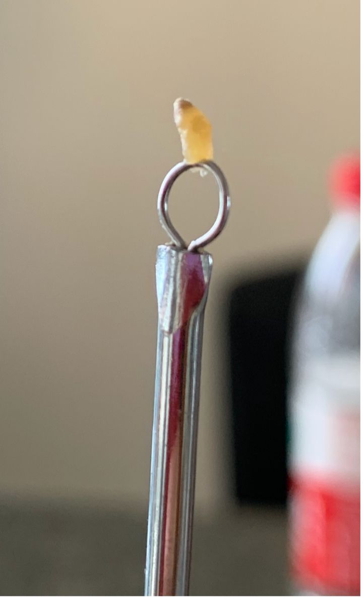 20年的黑头有多大,世界上最长的黑头到底有多长