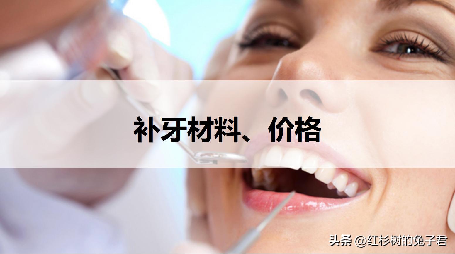 3mz250树脂补牙多少钱一颗,大牙补牙树脂材料250和350哪种好