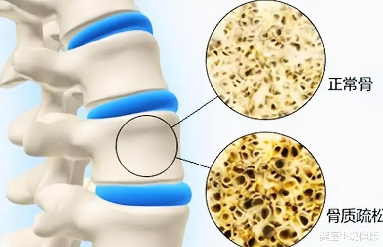 哈欠不断千万别大意！如果出现这些症状，赶紧查！可能会致命！