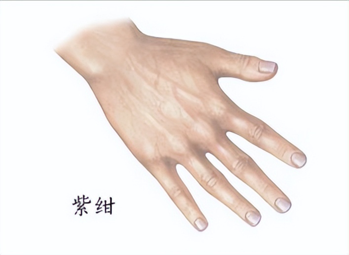 为什么我指甲都变了颜色了,为什么我的指甲是紫色的